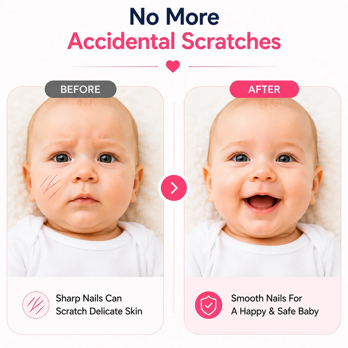 Baby nail cutter